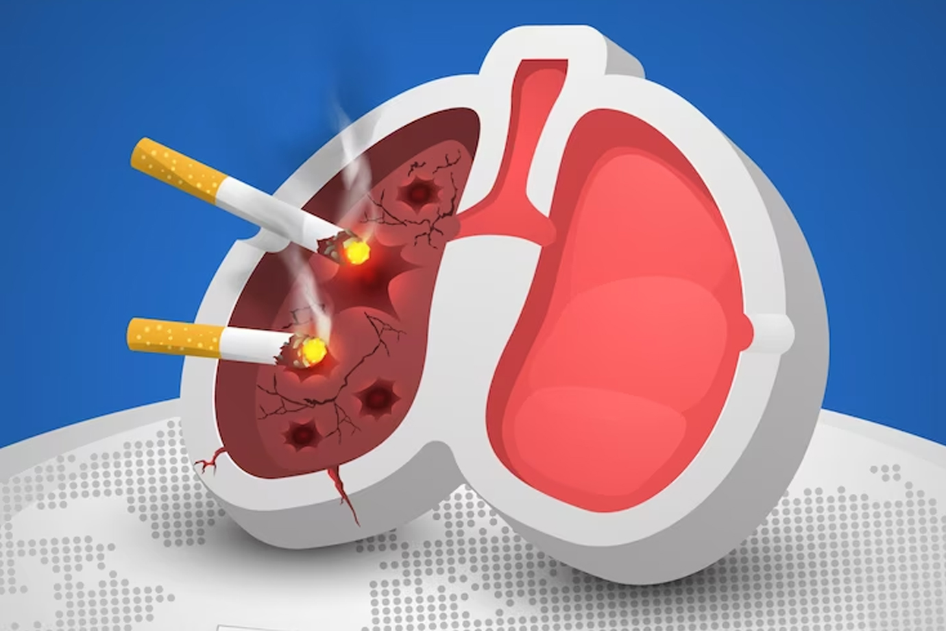Smoking Cessation:
